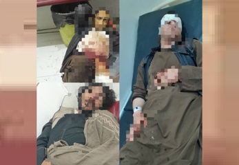 Three thieves arrested in injured condition in Nangarhar 