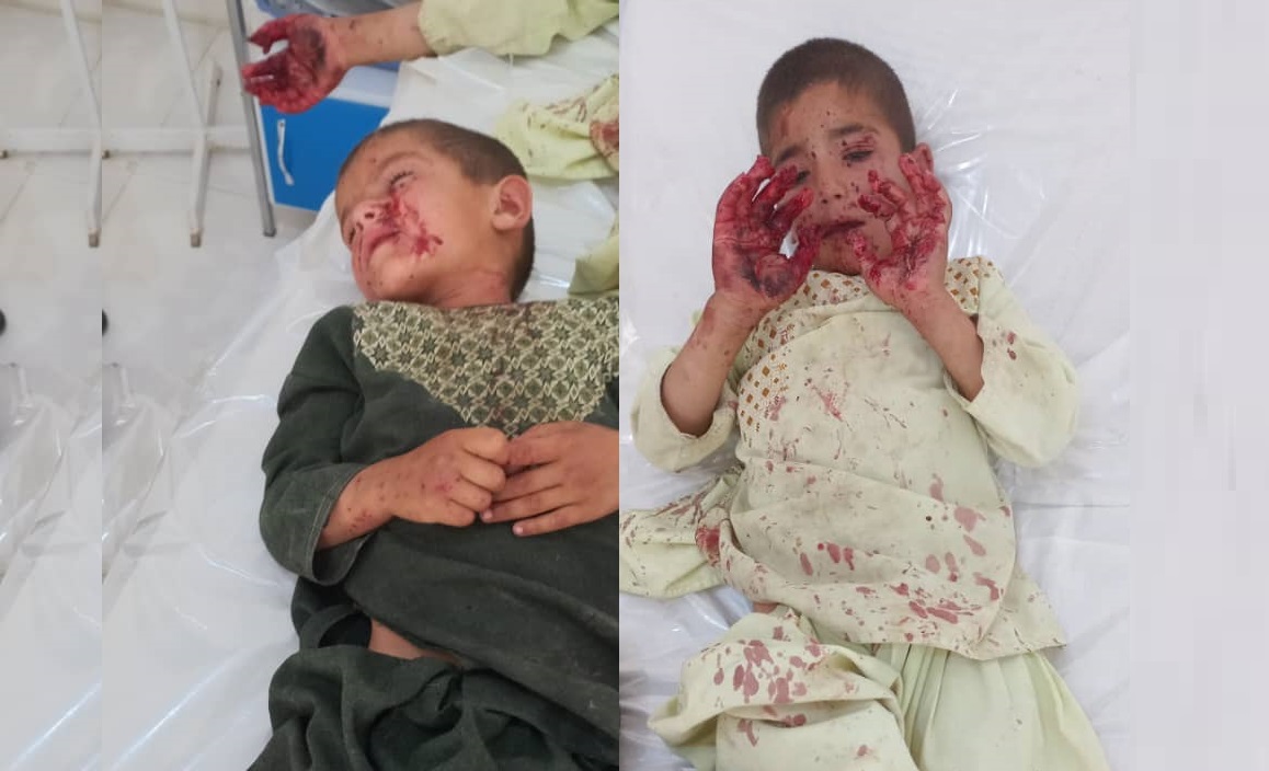 UXO injures two children in Helmand