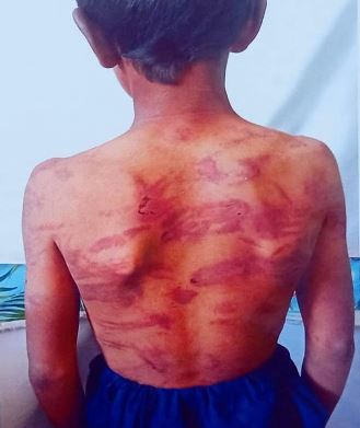 Three children released from step-mother’s home imprisonment, torture