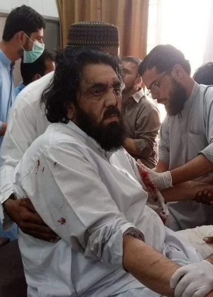 JUI-F leader injured in Balochistan blast 