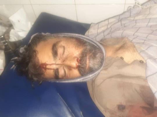خپلمنځي شخړه کې دوه تنه مړه او درې ټپيان شول