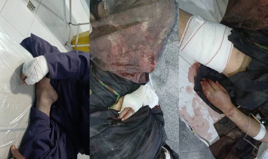 درې وسله وال غله په ټپي حالت کې ونيول شول