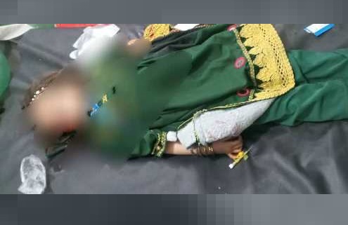 لوګر کې د  ډزو له کبله دوو ماشومانو ته مرګ ژوبله رسيدلې